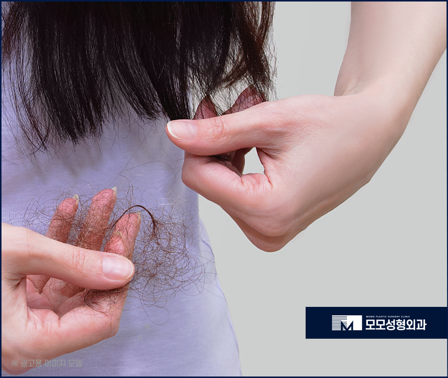 출산후머리빠짐 자연스러운 해결 방안에 대하여 관련 이미지 5