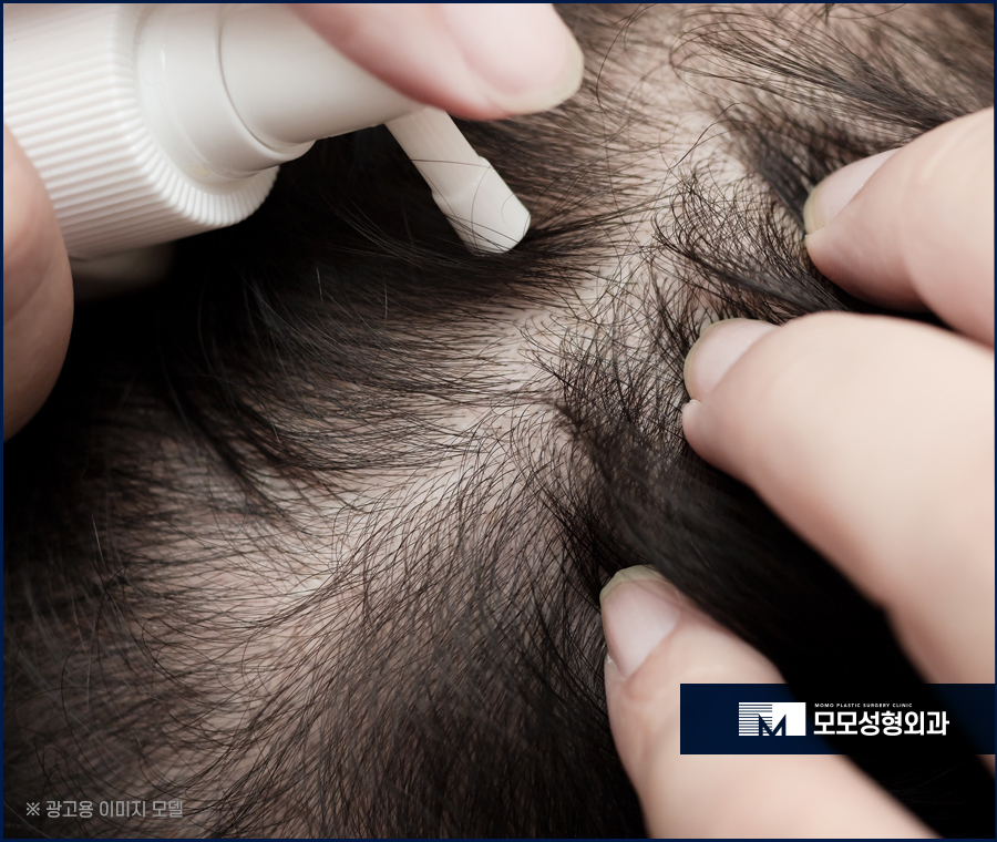 두피 피지알갱이 원인과 없애는 방법은 관련 이미지 10