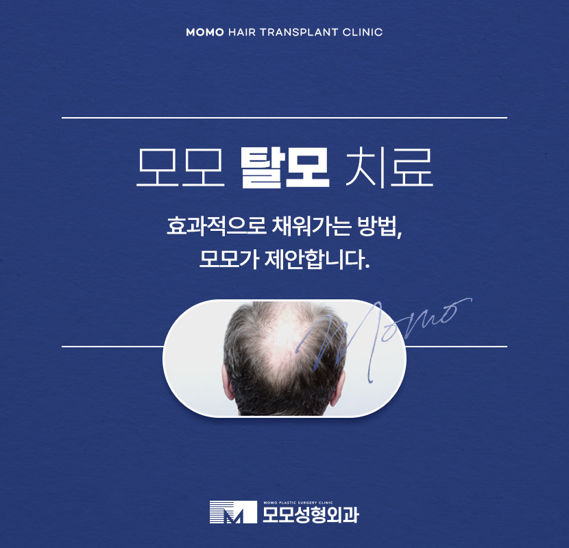 탈모 클리닉 비용의 기준이 되는 조건은? 관련 이미지 1