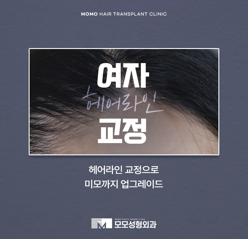 여자 모발이식 헤어라인 교정이 필요하다면 관련 이미지 1