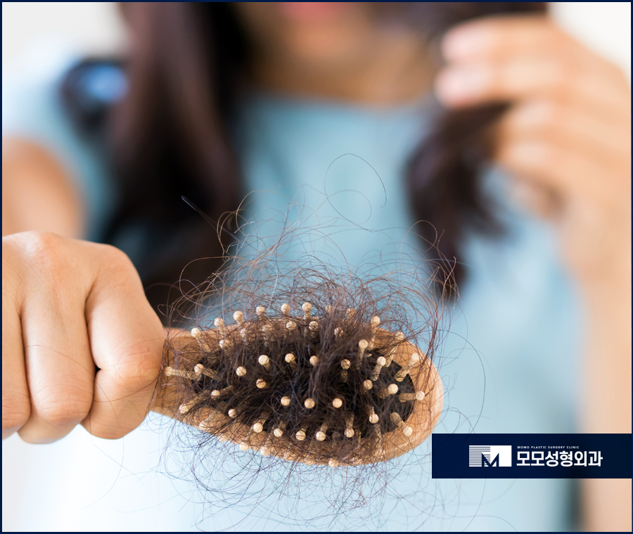 모발이식2달 차에 일어나는 달라짐에 대해서 관련 이미지 4
