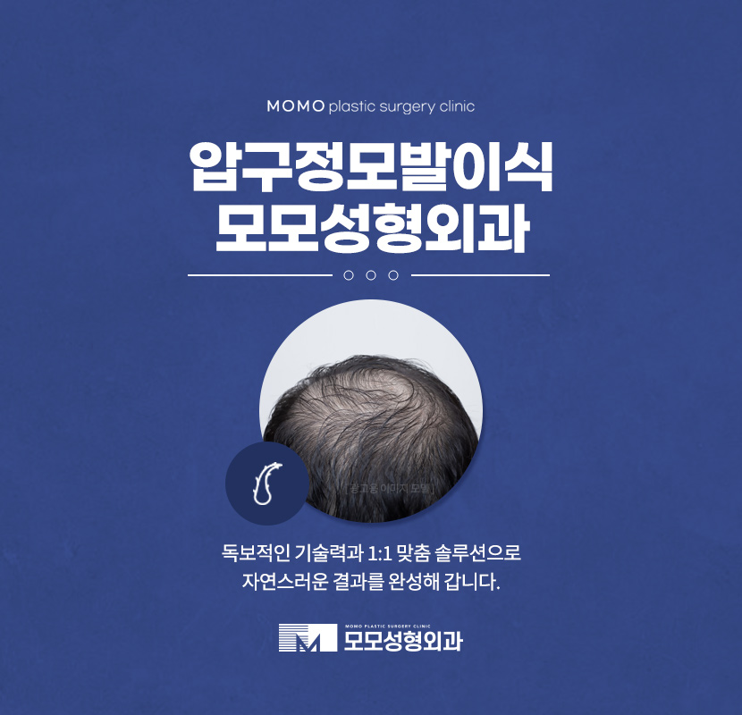 압구정모발이식 훌륭한 결과를 위해서는 관련 이미지 1