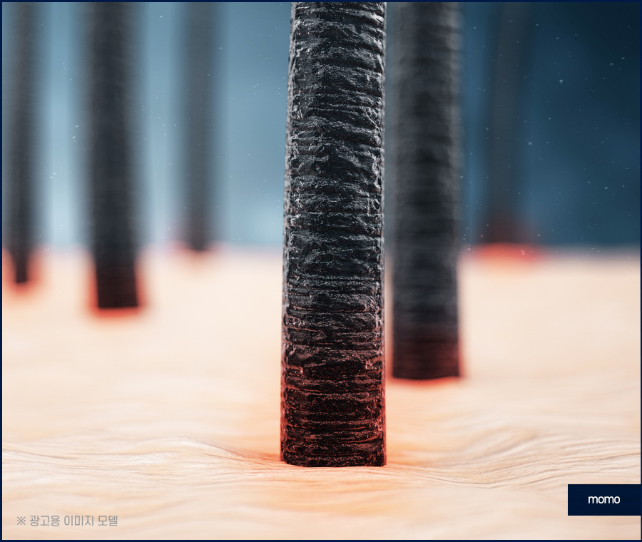 절개모발이식 차이점을 알고 정해야만 관련 이미지 5