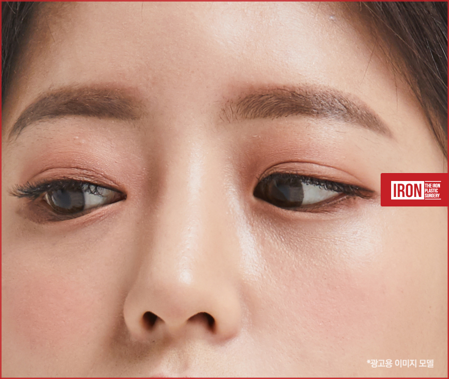 쌍수 라인 종류는 어떤 것들이 있는지 관련 이미지 5