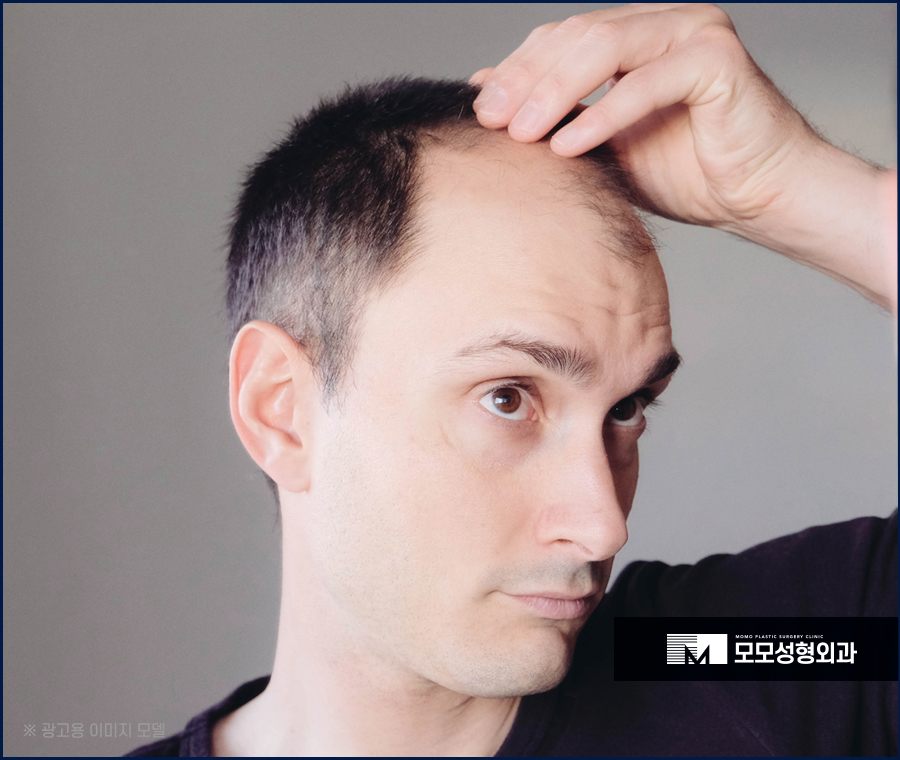 모발이식3000모 비용만 살피기 보단 관련 이미지 2