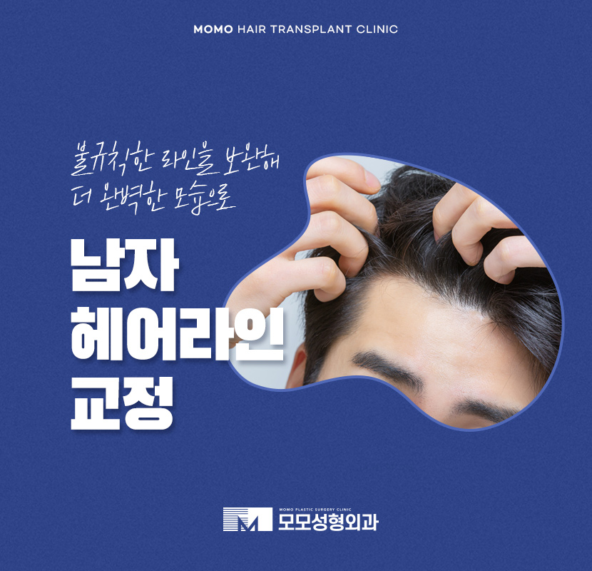 남자 헤어라인 교정 불규칙한 라인 보완을 위해 관련 이미지 1