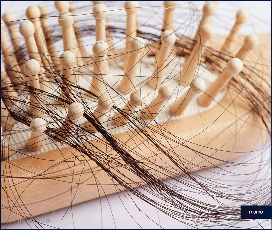강남 탈모 병원 원인 파악부터 철저하게 시작하는 곳 관련 이미지 4