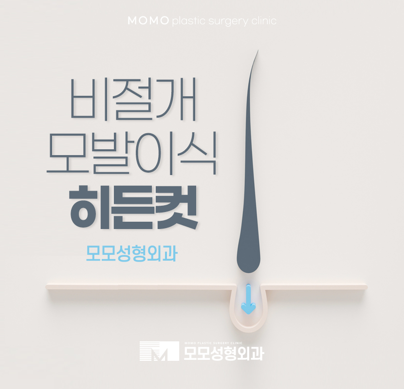비절개모발이식 히든컷 멋스러움을 더해 관련 이미지 1