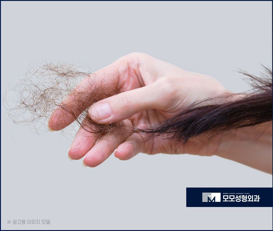 출산후 탈모 언제까지 지속되는지 여부와 개선 방안 관련 이미지 4