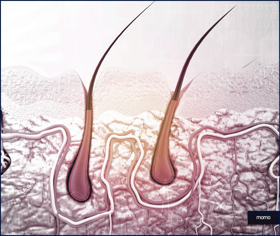 모발이식재수술 원인 및 성공을 위한 핵심 2가지 관련 이미지 5