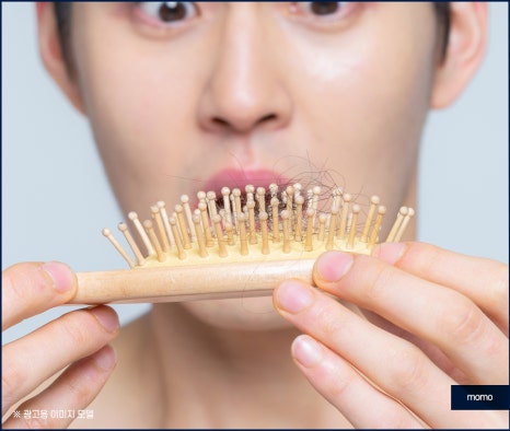 압구정 모발이식 탈모 문제를 해소하는 관련 이미지 6