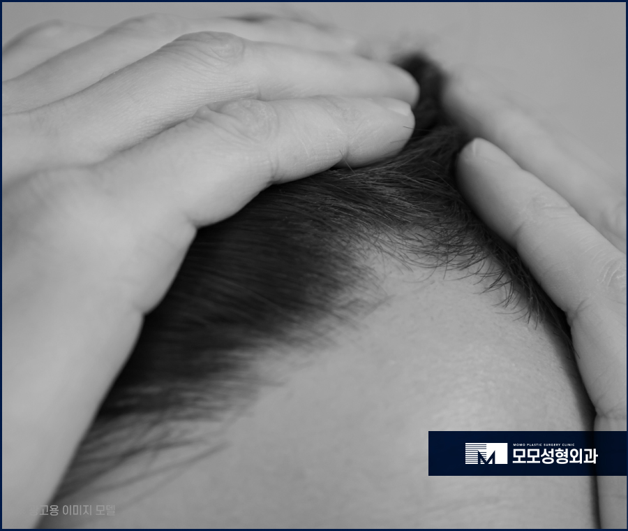 40대여자앞머리탈모 보강이 필요한 이유에 대해 관련 이미지 2