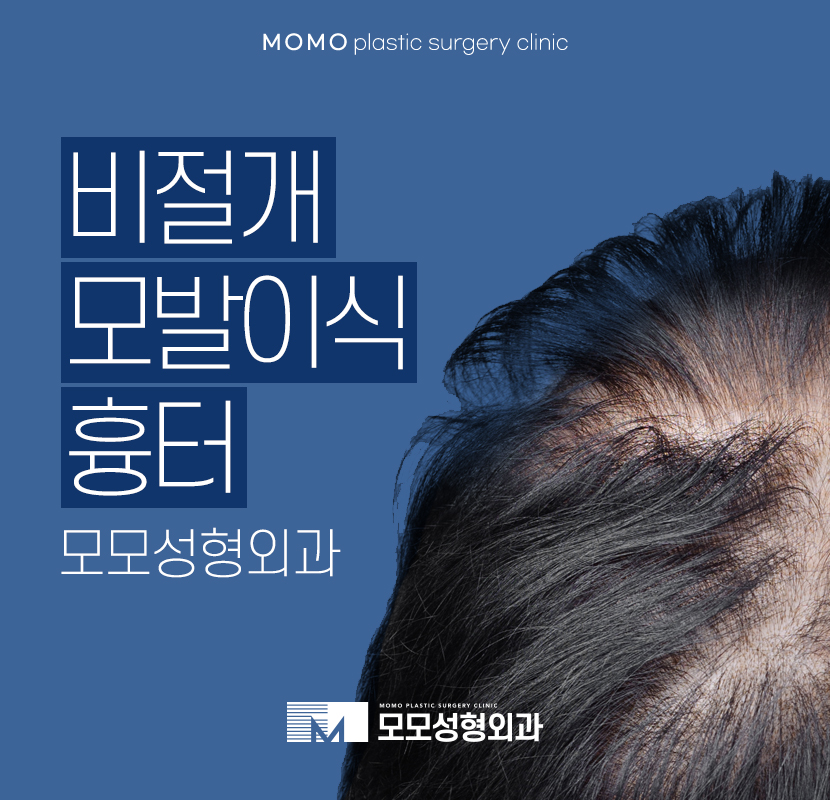 비절개모발이식흉터가 고민된다면 관련 이미지 1