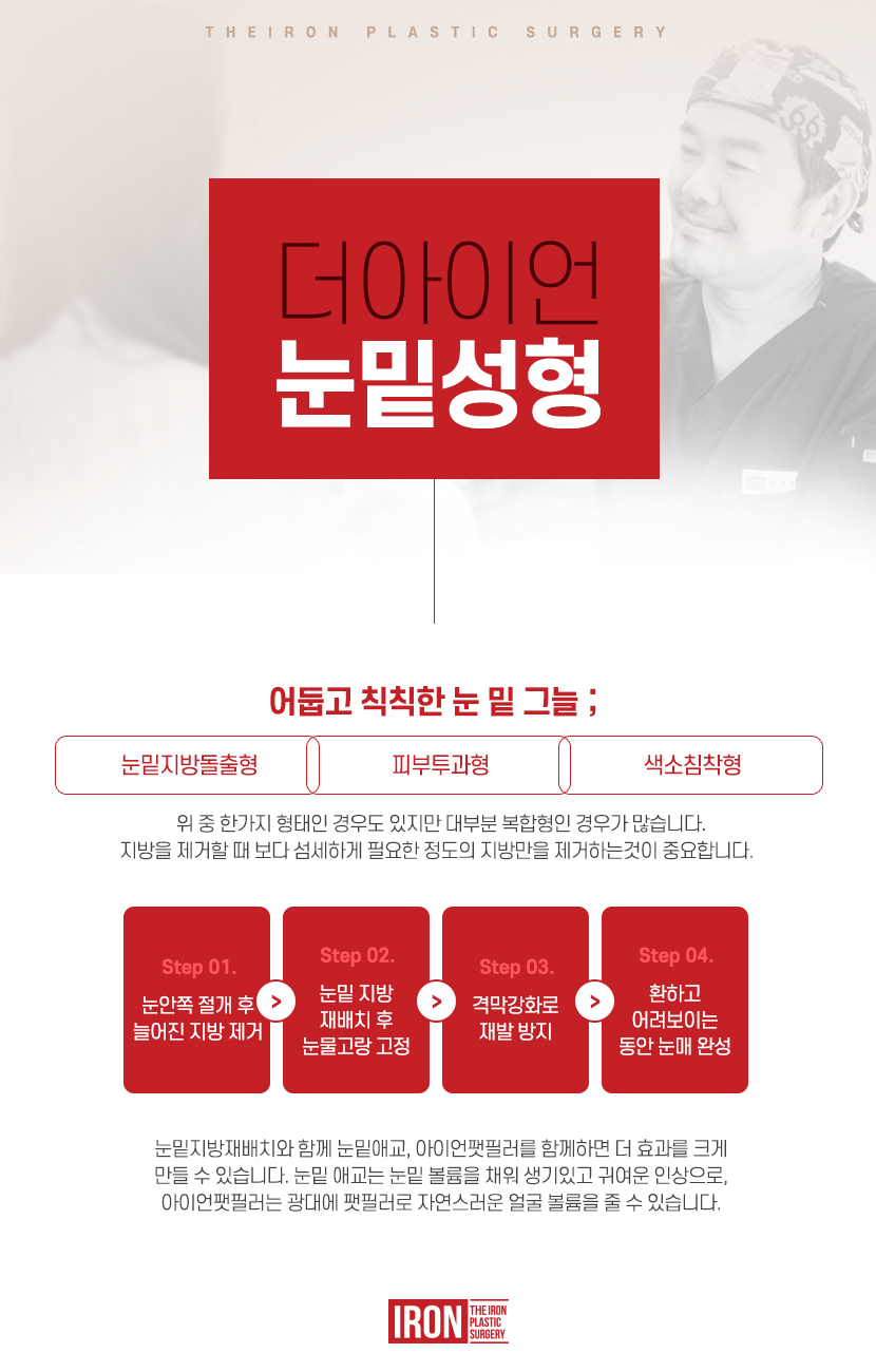 신사 눈밑지방이식 만족스러운 모습을 관련 이미지 8