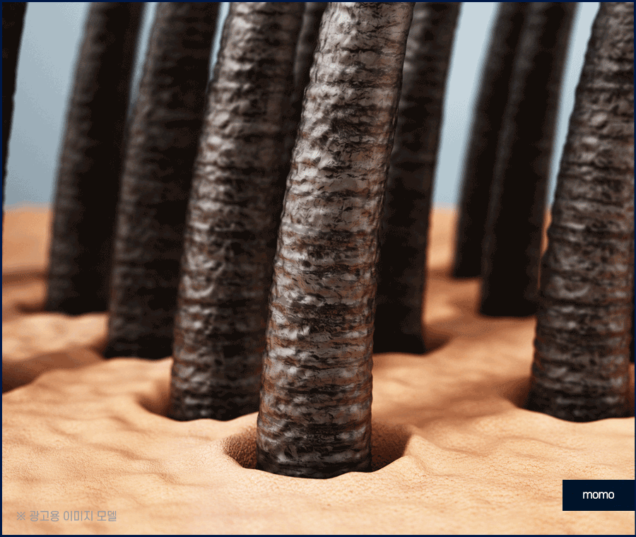 여자M자탈모 회복을 위한 맞춤 솔루션 관련 이미지 2