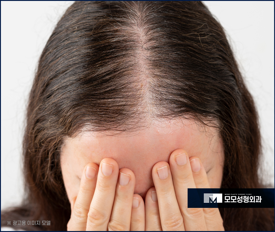 여자모발이식후기 다양하게 비교해 보아야만 관련 이미지 4