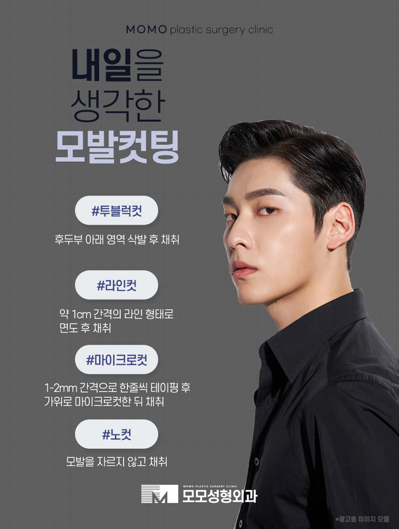 모발이식2000모 자연스럽게 채우는 방향으로 관련 이미지 8