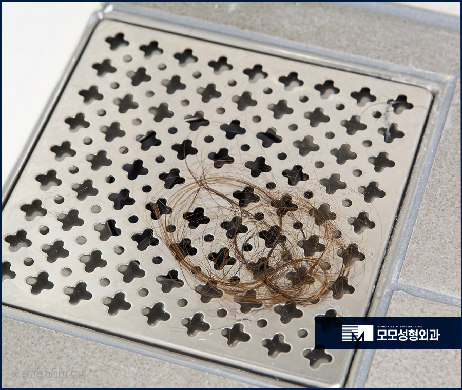 압구정모발이식 훌륭한 결과를 위해서는 관련 이미지 2
