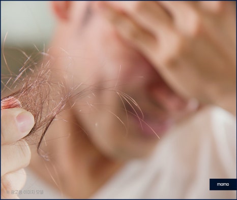 강남 모발이식 병원 차이가 나는 이유는 관련 이미지 2