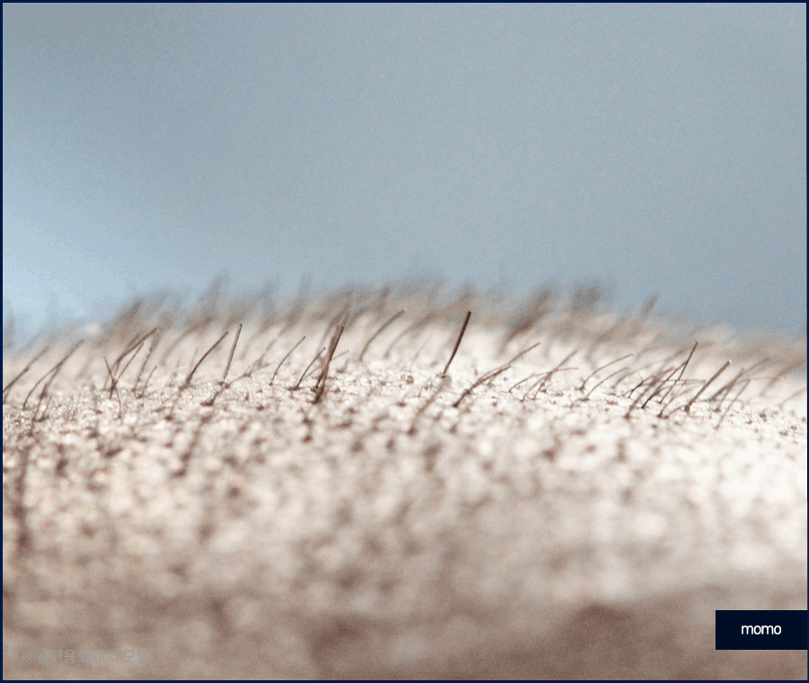 모발이식병원추천 개인에게 맞춰 진단하는 곳으로 관련 이미지 6