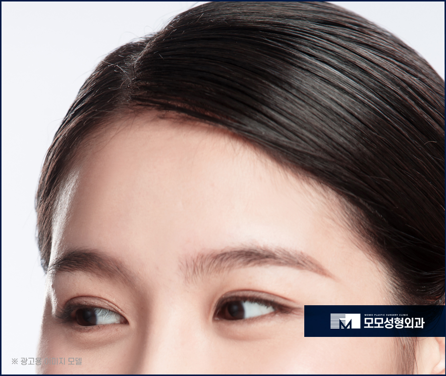 여자헤어라인모발이식 정돈된 미모를 완성하는 방법 관련 이미지 2