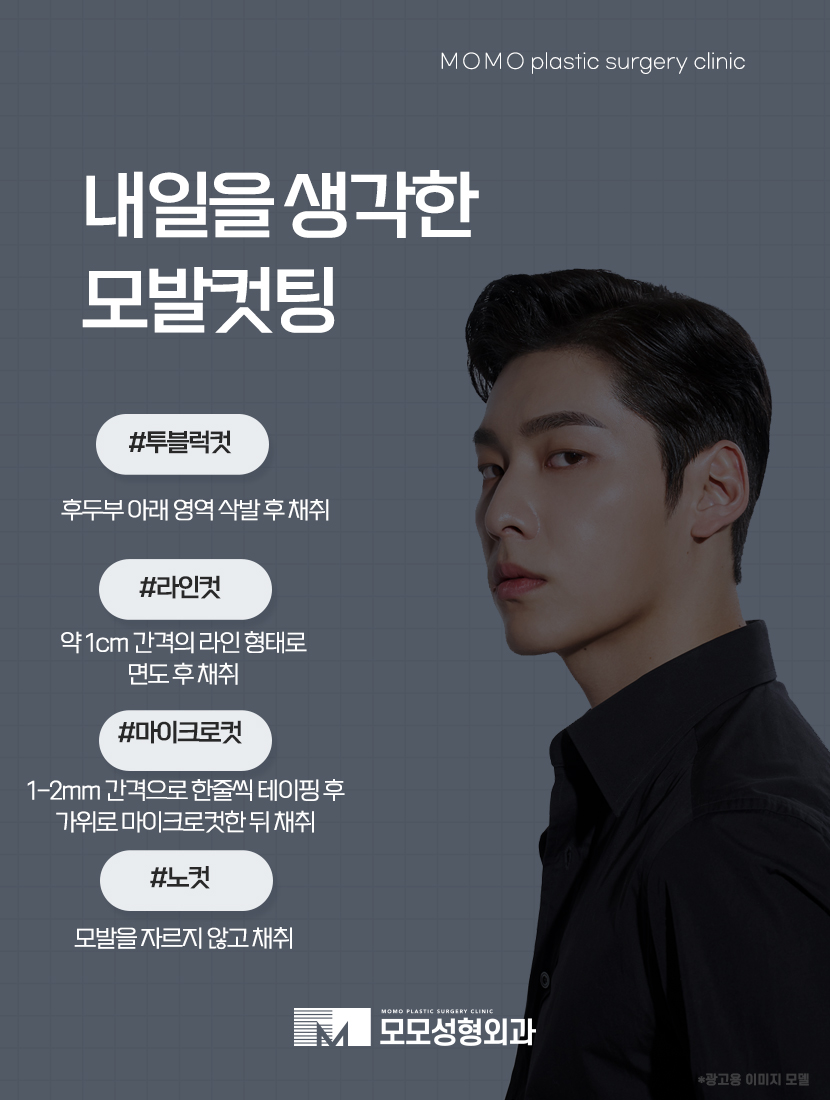 모발이식 3000모 어떤 분들에게 적절할까요 관련 이미지 10