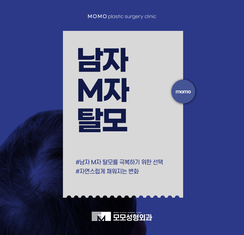 남자M자탈모 자연스럽게 채워지는 변화 관련 이미지 1