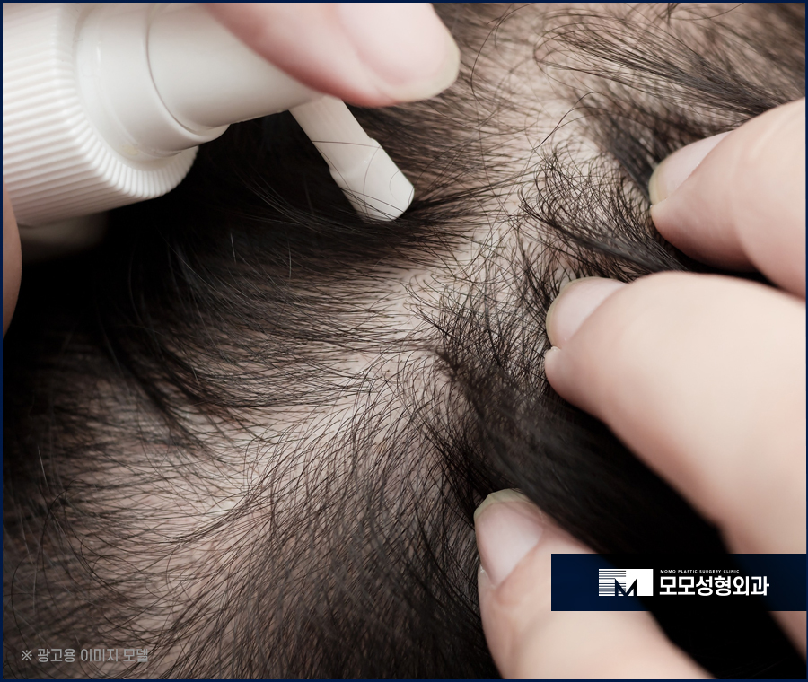 미녹시딜부작용 미리 알고 올바르게 관련 이미지 6