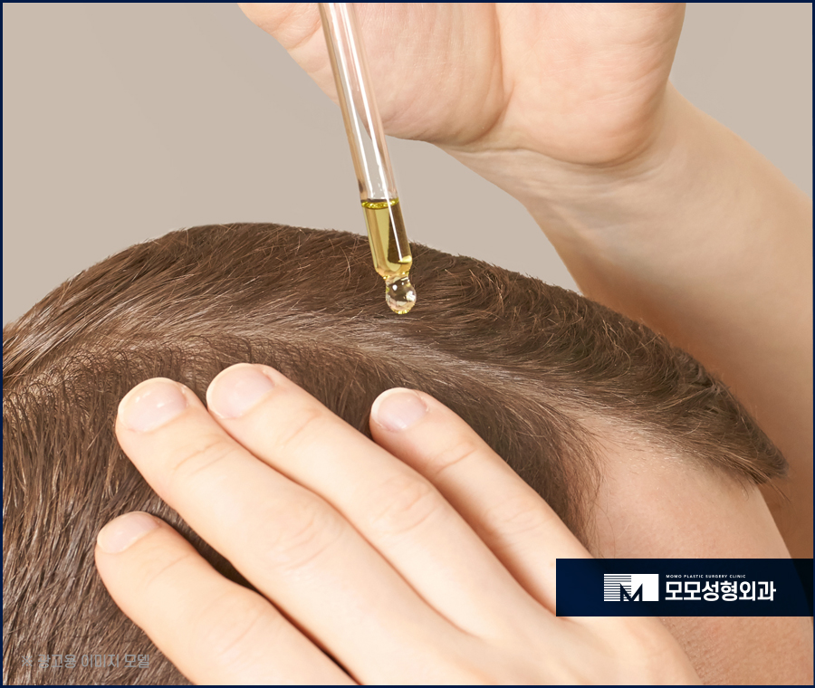 모발이식 2주 조심해야 할 부분과 관리 방법 관련 이미지 4
