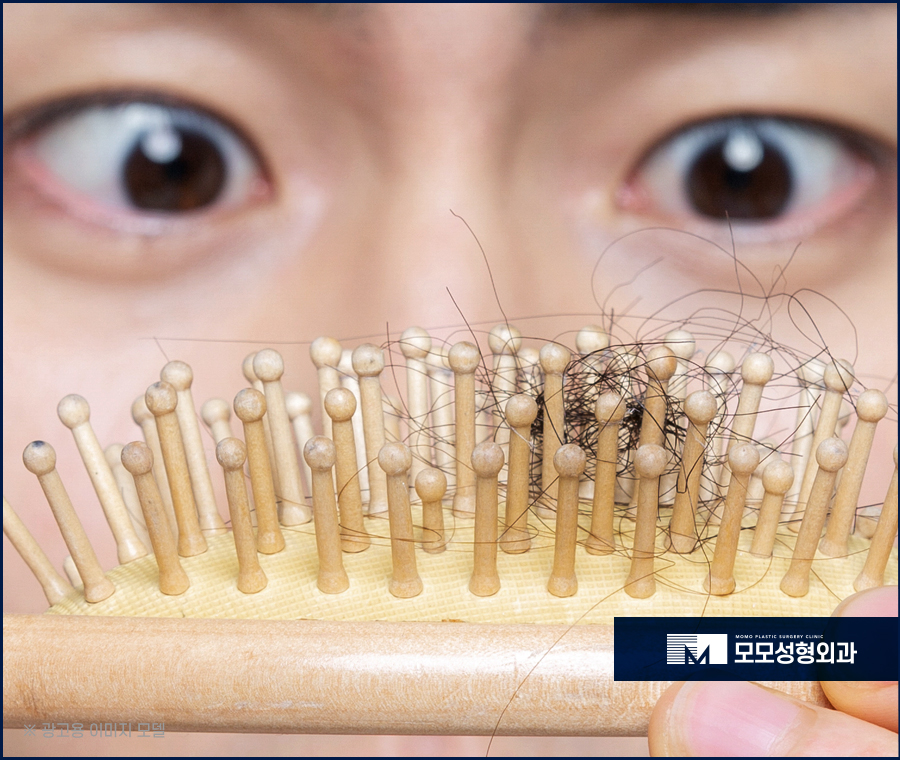 강남역 모발이식 빈 곳을 채우며 풍성하게 관련 이미지 4