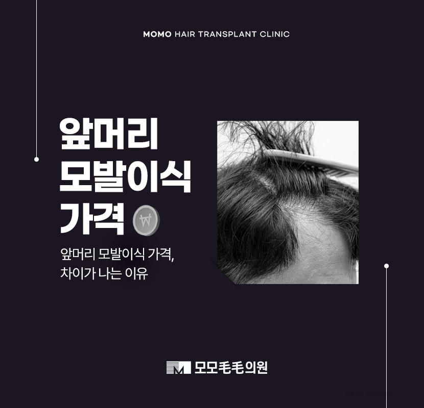 앞머리 모발이식 가격 차이부터 확인하며 관련 이미지 1