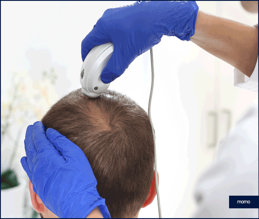 서울 탈모 성지 풍성함을 만들기 위한 방법 2가지 관련 이미지 10