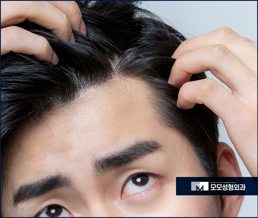 강남역 모발이식 빈 곳을 채우며 풍성하게 관련 이미지 2
