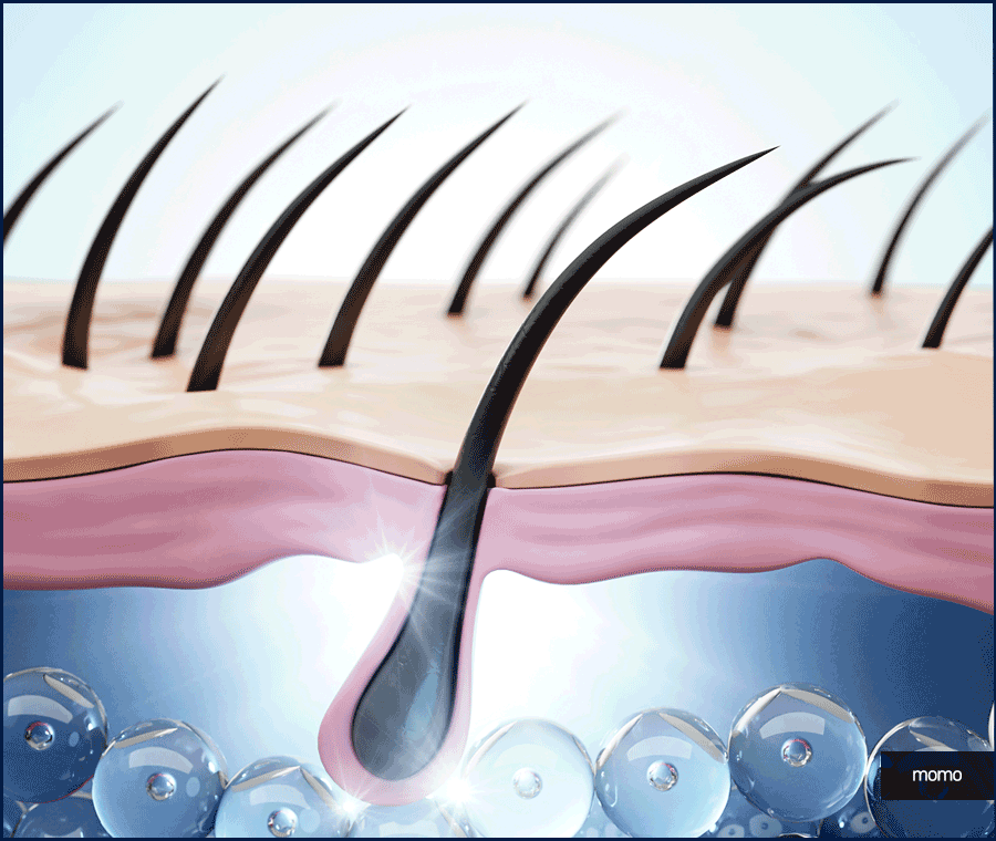탈모약 처방 및 주의사항, 회복을 위한 대안 관련 이미지 3