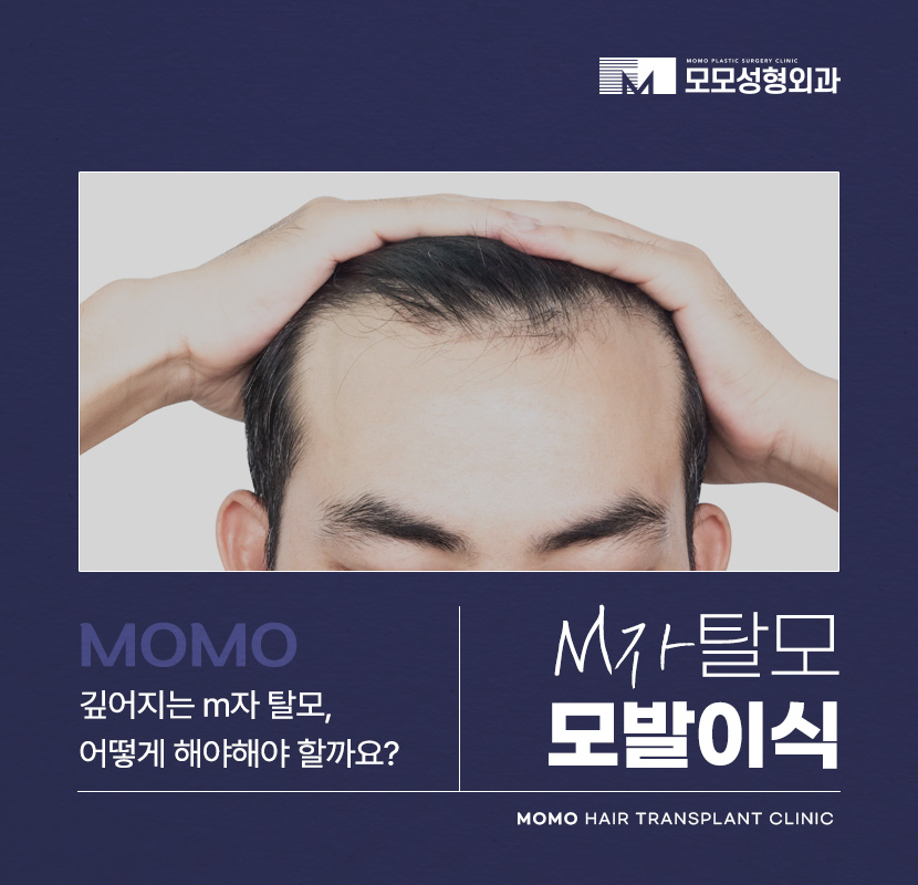 m자탈모병원 모발이식 고민이신 분들이라면 필독 관련 이미지 1