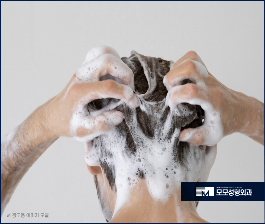 비듬이생기는이유와 해결을 위한 방법 관련 이미지 5