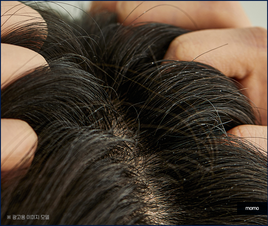 머리 비듬 생기는 이유부터 제거하는 효과적인 방법 관련 이미지 4