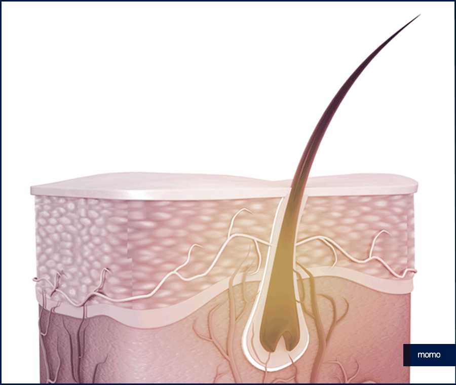 모발이식재수술 원인 및 성공을 위한 핵심 2가지 관련 이미지 8