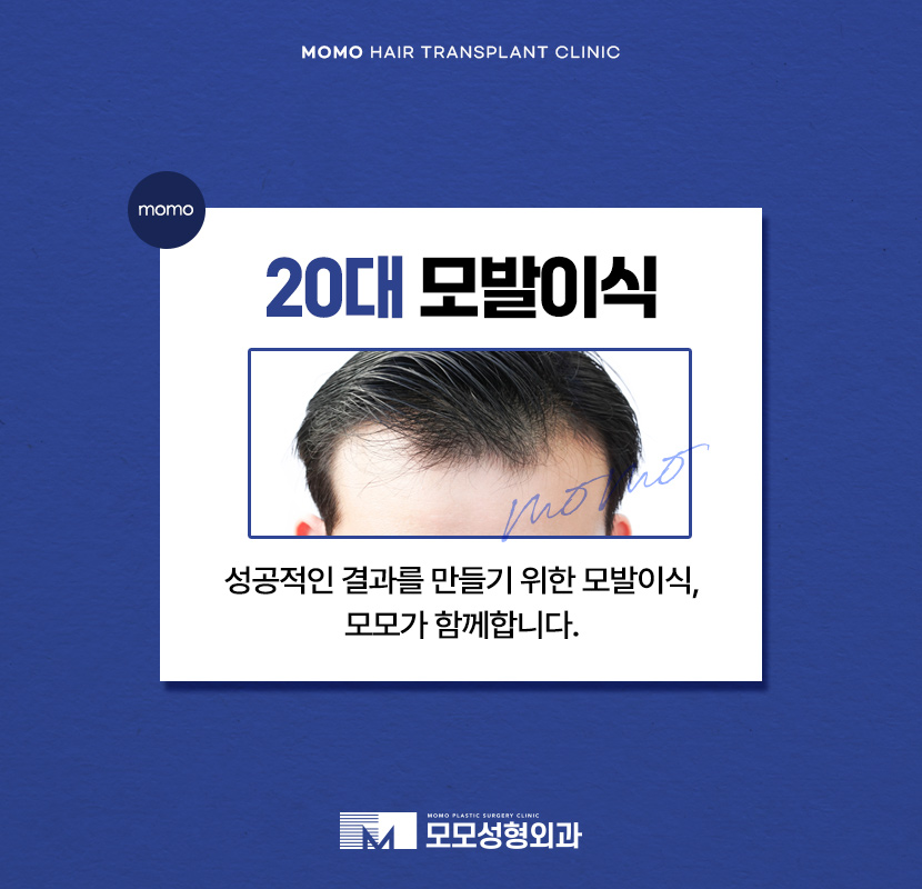 20대 모발이식 성공적인 결과를 위한 필수 조건 관련 이미지 1