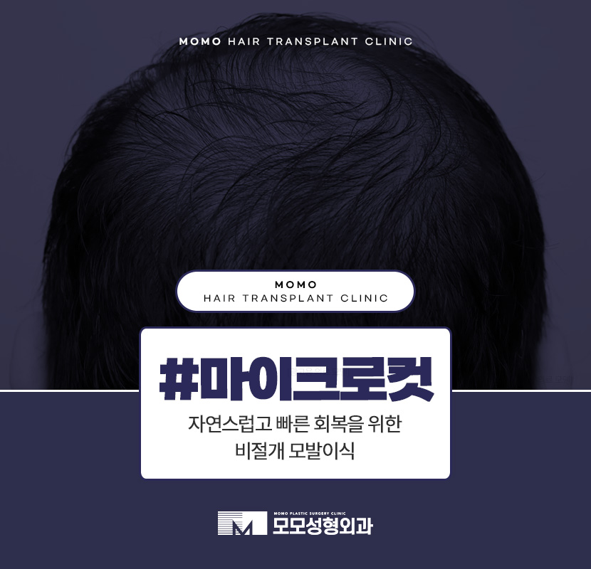 마이크로컷 비절개 모발이식 자연스러운 이후 외모를 관련 이미지 1