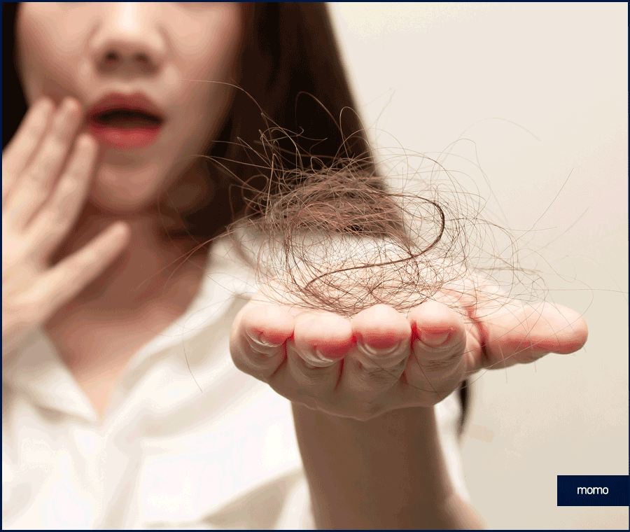 여자 모발이식 헤어라인 교정이 필요하다면 관련 이미지 2