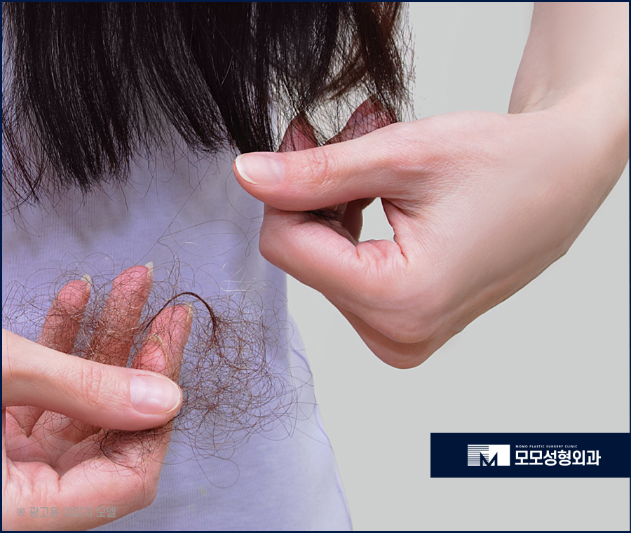 여성모발이식비용 알아 볼 때 고려해야 하는 점 관련 이미지 3