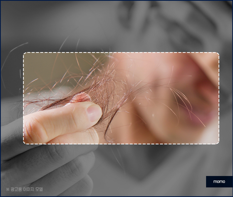 압구정탈모병원 절개가 부담스러울 경우 대안까지 관련 이미지 2