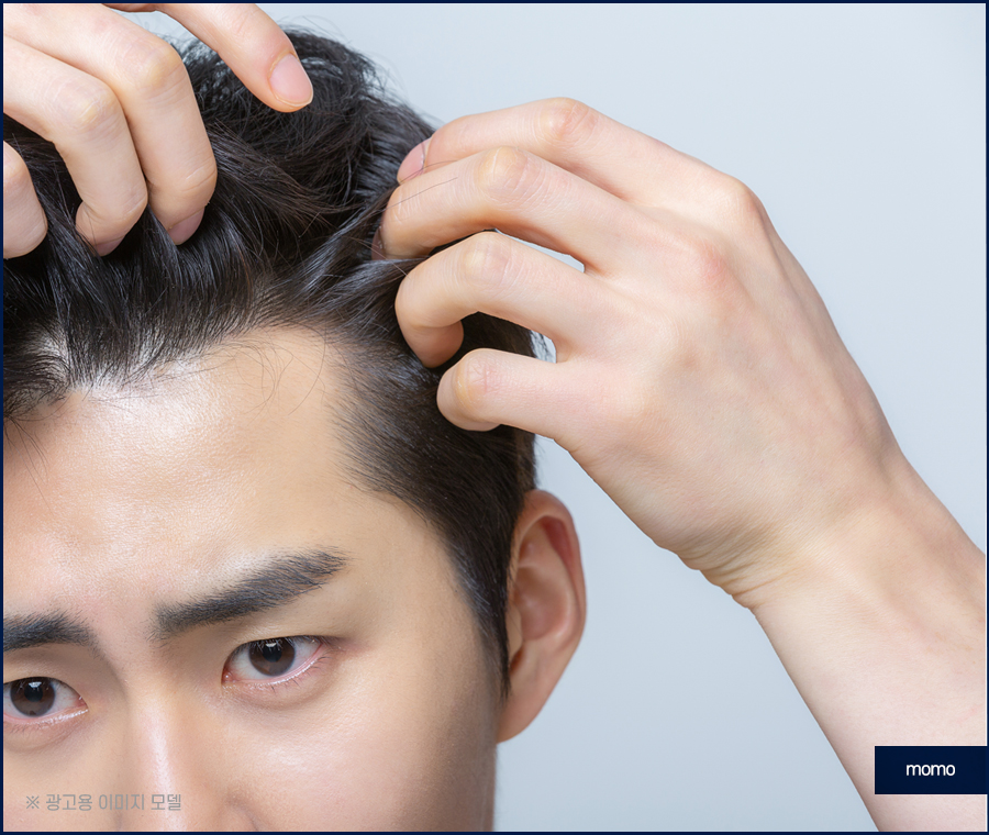 엠자이마 고민 탈출을 위한 모발이식 관련 이미지 2
