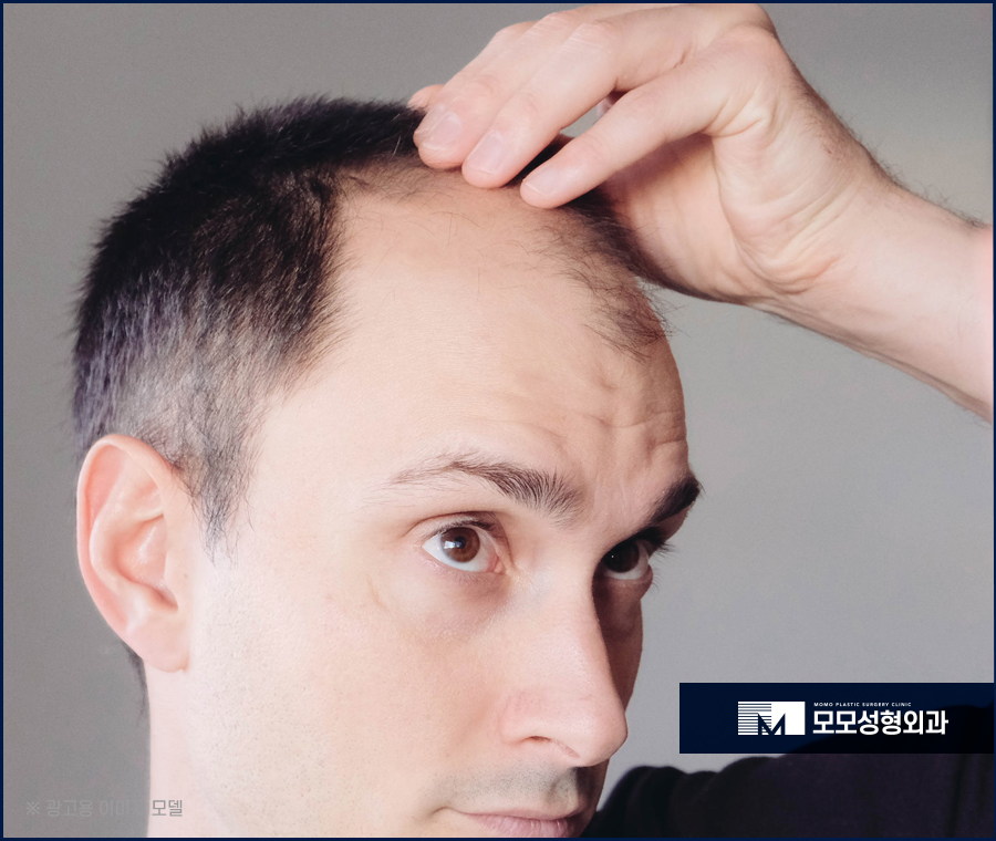 두피가려운이유 원인에 대해서 알아보는 관련 이미지 7