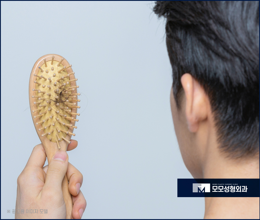 머리카락이식비용 대략적인 수준은 관련 이미지 3
