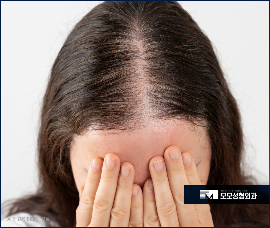 미녹시딜여자 효과와 치료 방안에 대해 관련 이미지 8