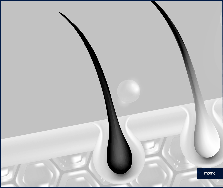 모발이식전후 확인 중이라면 꼭 체크할 핵심 요소 관련 이미지 5