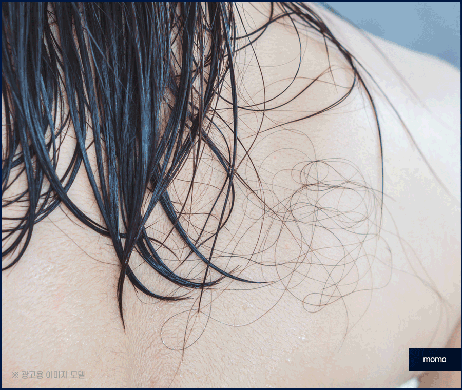 여자M자탈모 회복을 위한 맞춤 솔루션 관련 이미지 3