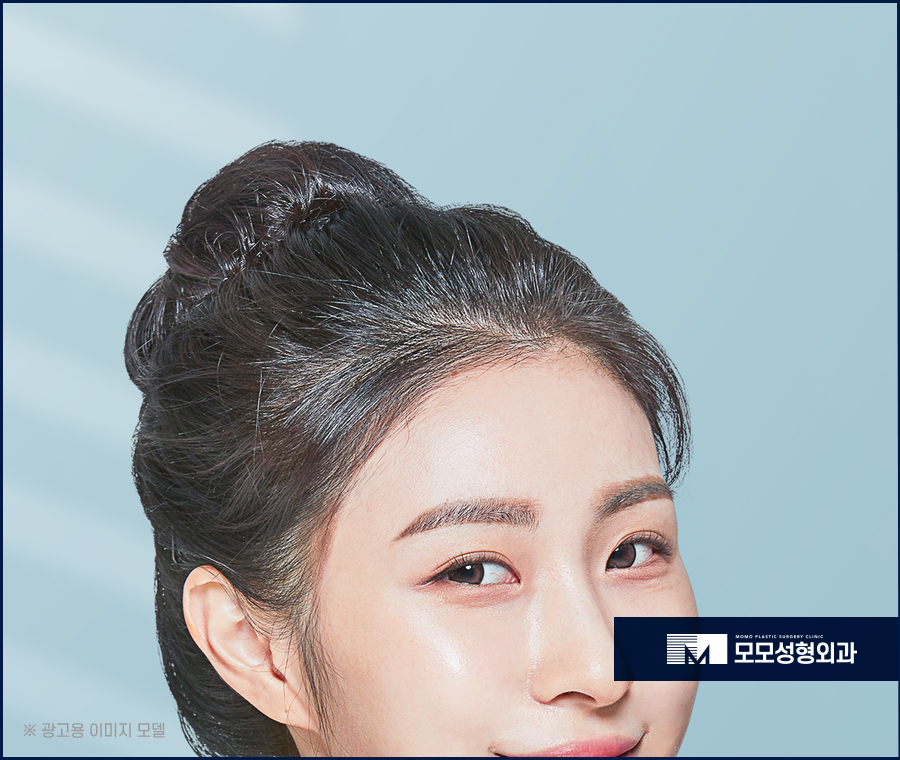 여성헤어라인모발이식 다양한 스타일링을 위해 관련 이미지 4